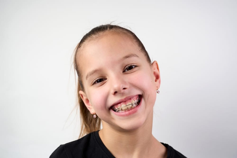 Retainers for children The Dalles